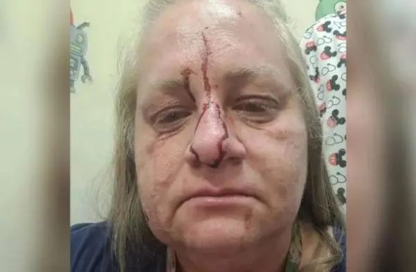 A médica pediatra Andrea Cabral foi agredida pela mãe de uma paciente no Hospital Municipal Albert Schweitzer, em Realengo, zona oeste do Rio de Janeiro — Foto: Reprodução/Instagram